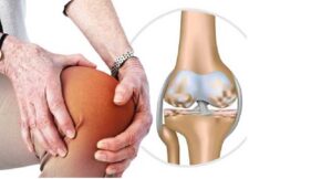 5 phương pháp điều trị thoái hóa khớp hàng đầu hiện nay