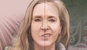 6 nguyên nhân hàng đầu dẫn đến tình trạng lệch mặt