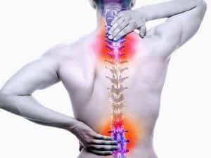 5 biến chứng của bệnh thoát vị đĩa đệm cực kỳ nguy hiểm