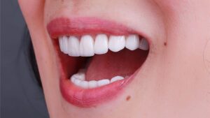 Há miệng có tiếng kêu là dấu hiệu của những bệnh lý nào?