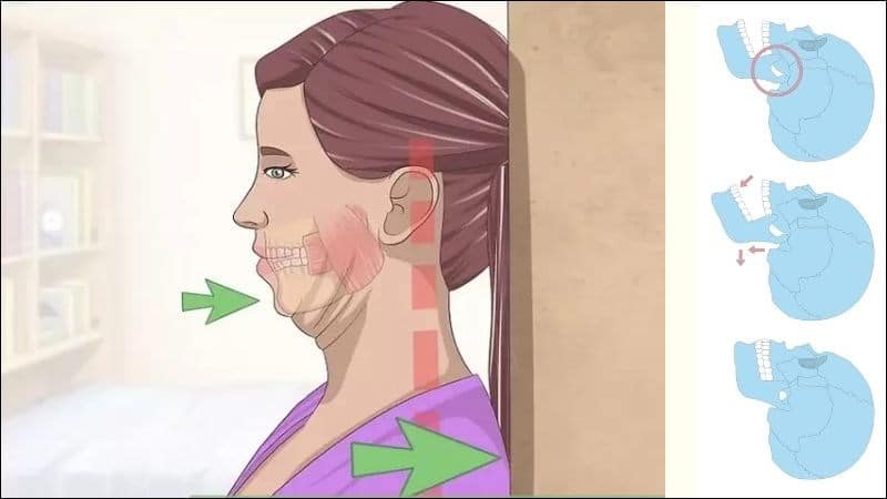 Bài tập 3: Tập lùi hàm, cải thiện hoạt động cơ hàm Bài tập 3: Tập lùi hàm, cải thiện hoạt động cơ hàm