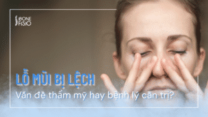 Lỗ mũi bị lệch: Vấn đề thẩm mỹ hay bệnh lý cần trị?