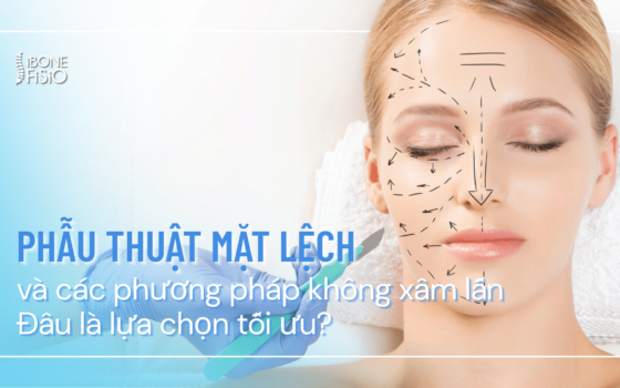 Phẫu thuật mặt lệch
