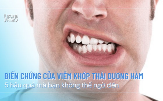 bien chung cua viem khop thai duong ham