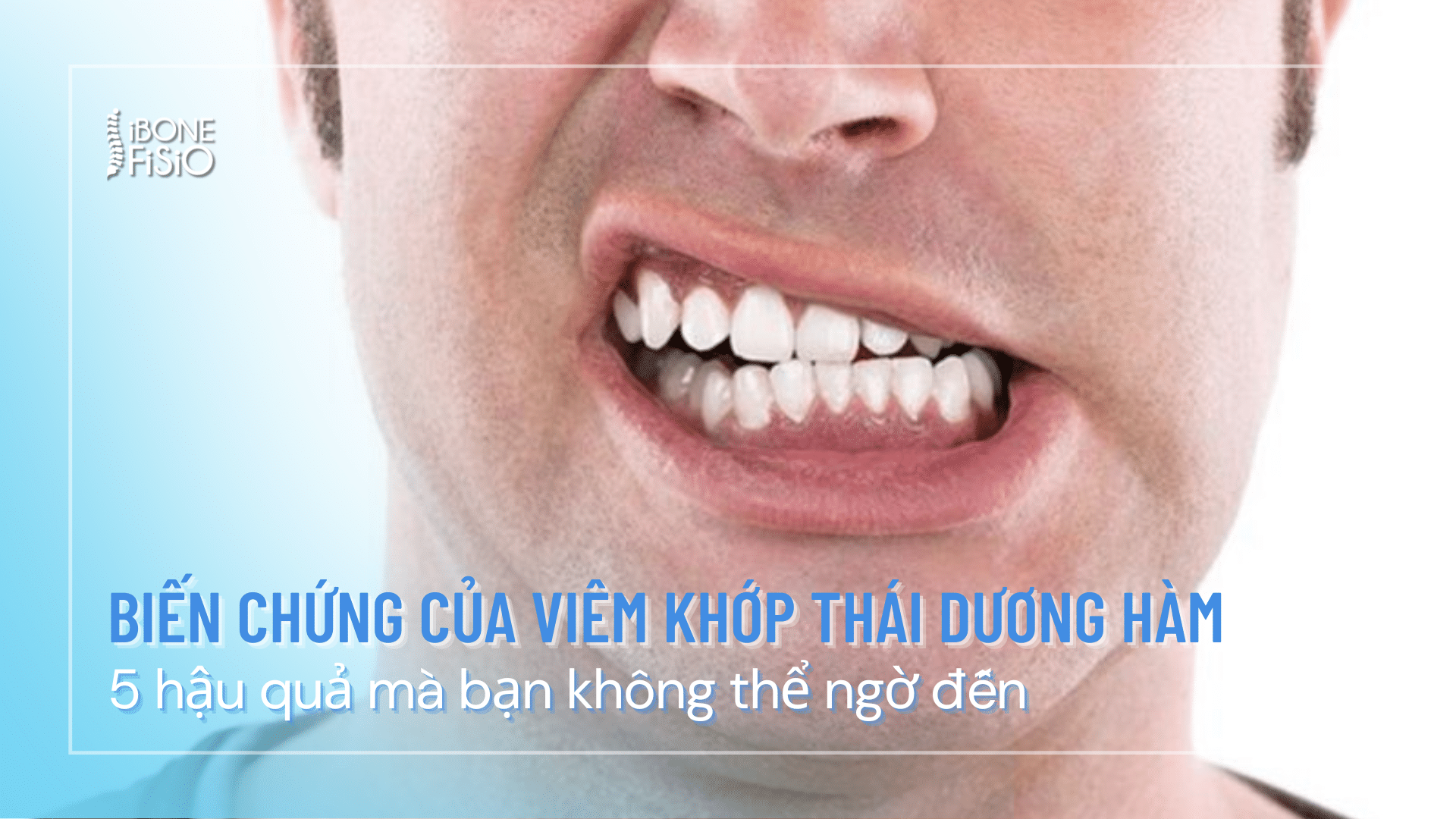 bien chung cua viem khop thai duong ham