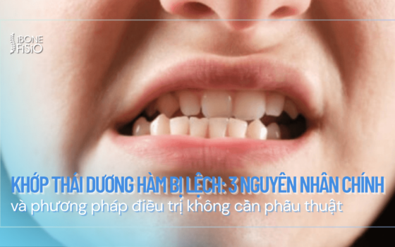 khop thai duong ham bi lech