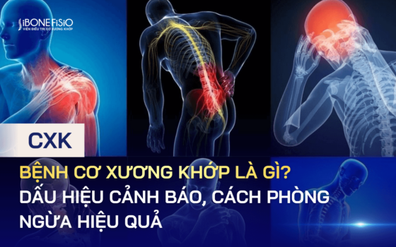 Bệnh cơ xương khớp là gì? Dấu hiệu cảnh báo, cách phòng ngừa hiệu quả
