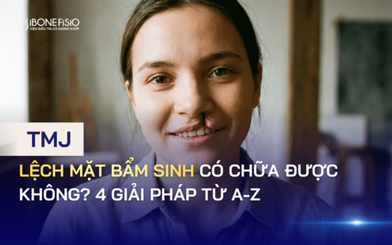 Lệch mặt bẩm sinh