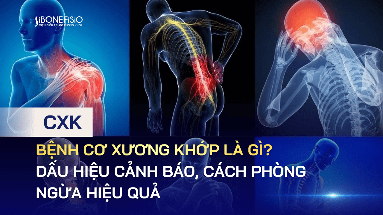 Bệnh cơ xương khớp là gì? Dấu hiệu cảnh báo, cách phòng ngừa hiệu quả