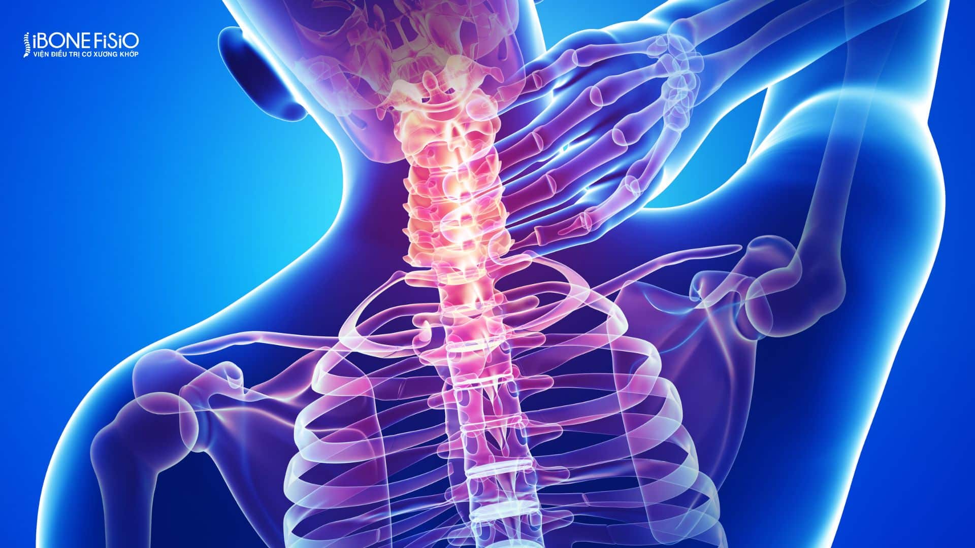 Chữa đau cổ vai gáy ở đâu Gò Vấp được nhiều người tin chọn 2 Đau cổ vai gáy kéo dài ảnh hưởng sinh hoạt hằng ngày