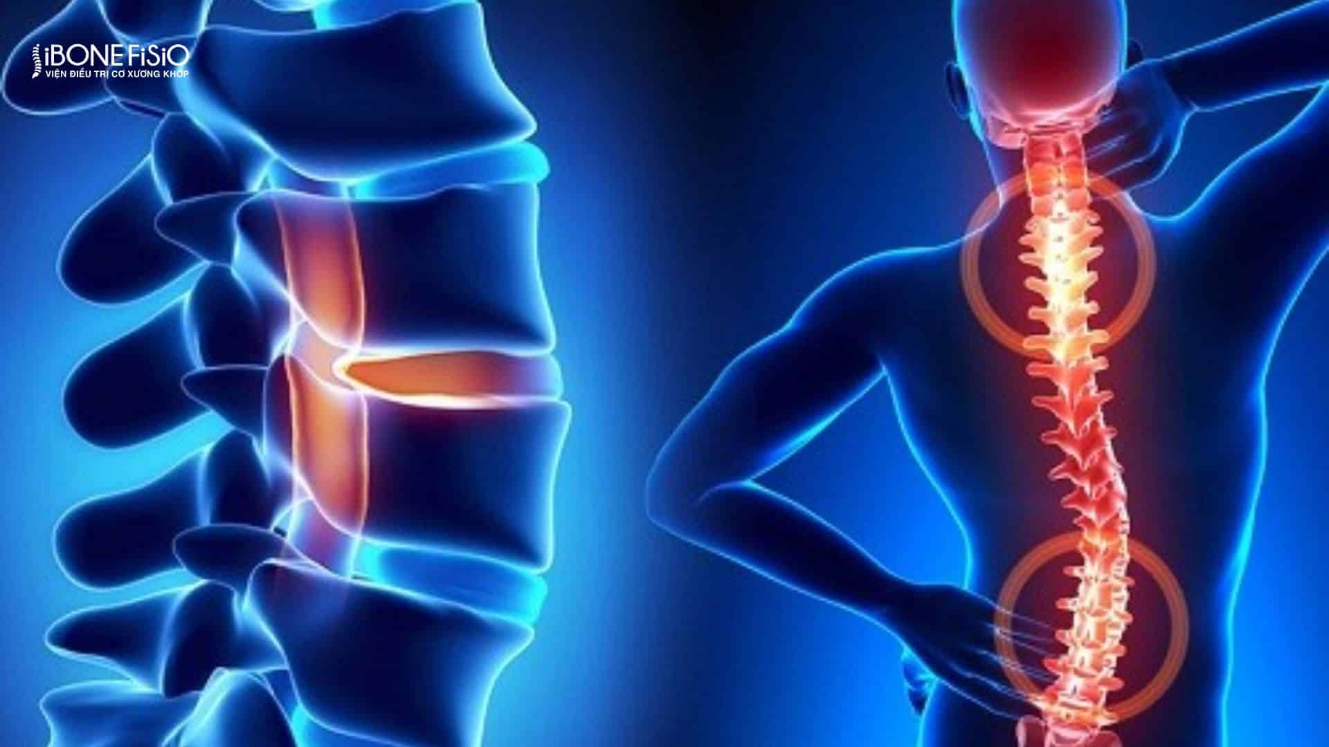 Đau lưng kéo dài khám ở đâu Gò Vấp để điều trị hiệu quả an toàn 2 Đau lưng kéo dài khám ở đâu gò vấp