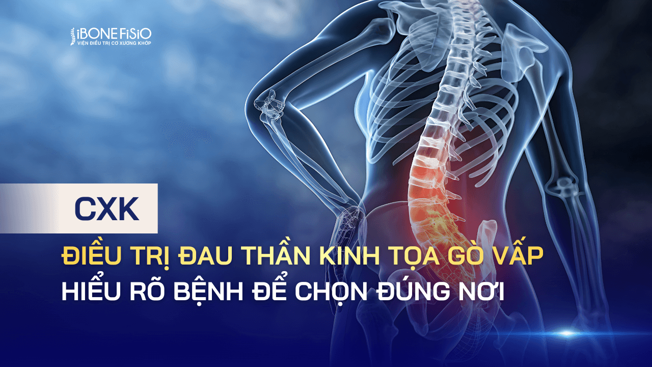 Điều trị đau thần kinh tọa Gò Vấp: Hiểu rõ bệnh để chọn đúng nơi