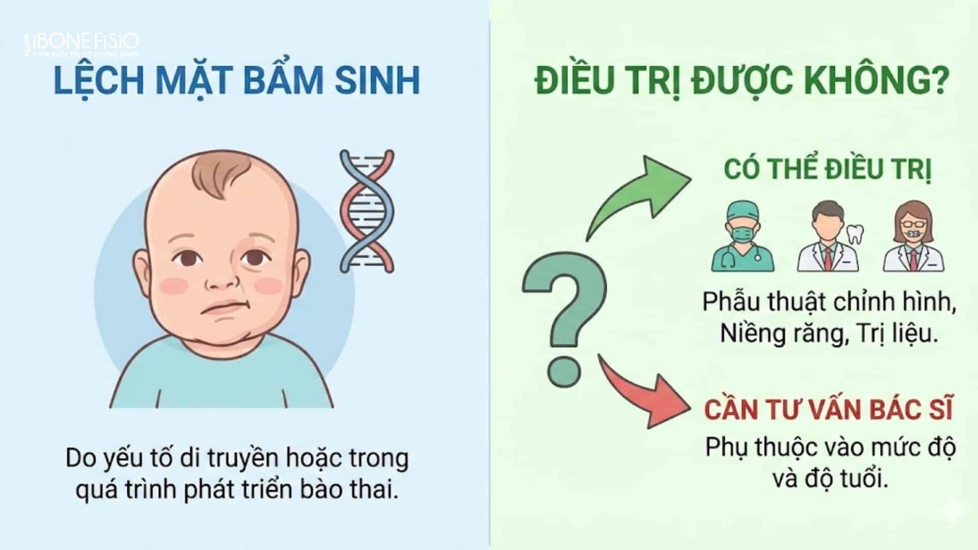Lệch mặt là gì? Nguyên nhân, dấu hiệu và cách khắc phục hiệu quả 8 Lệch mặt bẩm sinh di truyền
