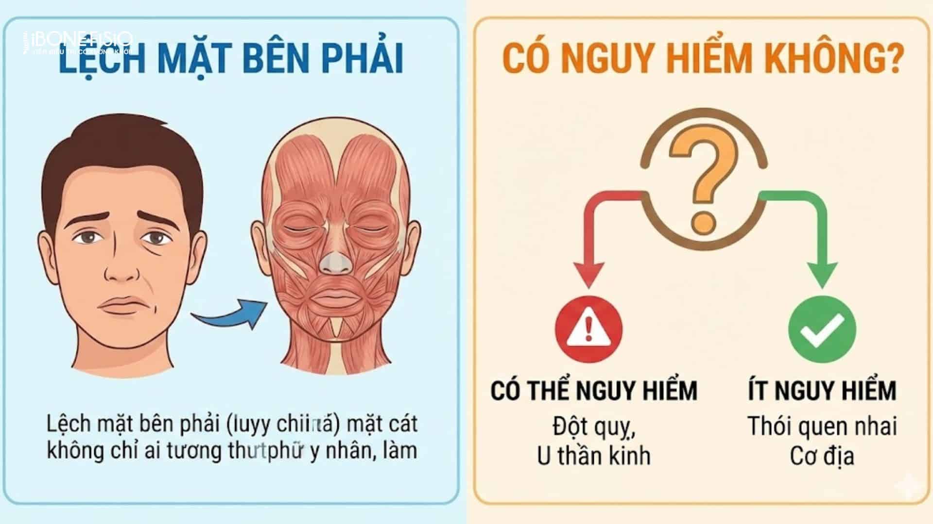 Lệch mặt là gì? Nguyên nhân, dấu hiệu và cách khắc phục hiệu quả 6 Các mức nguy hiểm lệch mặt bên phải