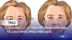 Lệch mặt là gì? Nguyên nhân, dấu hiệu và cách khắc phục hiệu quả