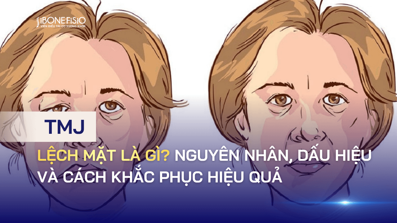 Lệch mặt là gì? Nguyên nhân, dấu hiệu và cách khắc phục hiệu quả