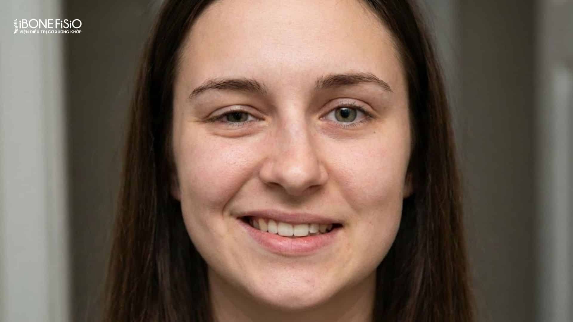 Nguyên nhân lệch mặt: 7 Thói quen tàn phá nhan sắc, cách khắc phục 3 Lệch nửa bên mặt