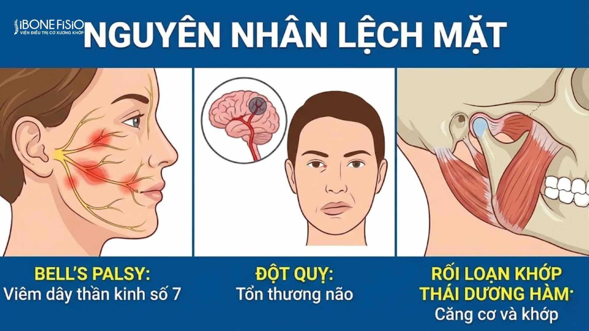 Nguyên nhân lệch mặt: 7 Thói quen tàn phá nhan sắc, cách khắc phục 2 Nguyên nhân lệch mặt