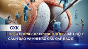 Triệu chứng cơ xương khớp: 7 Dấu hiệu cảnh báo và khi nào cần gặp bác sĩ