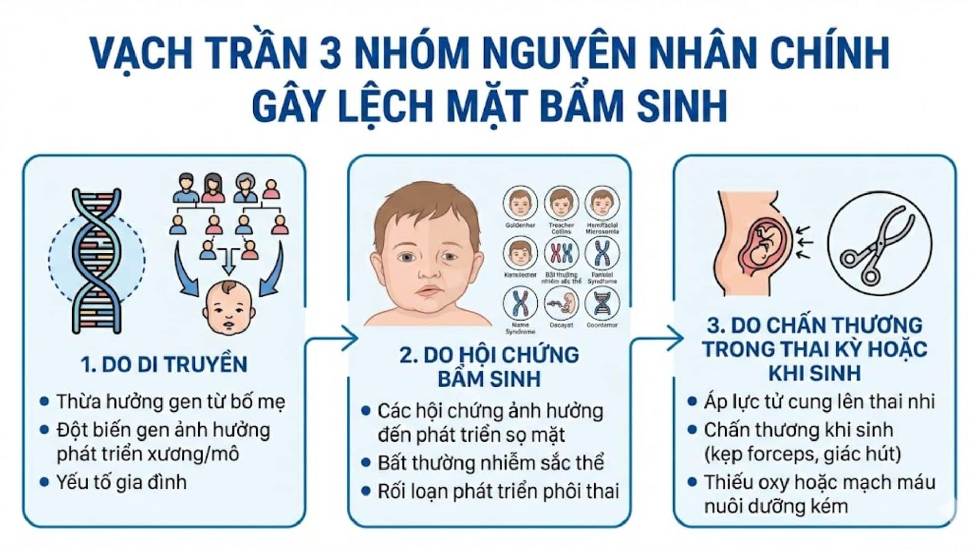 Lệch mặt bẩm sinh có chữa được không? 4 Giải pháp từ A-Z 4 3 Nguyên nhân chính gây lệch mặt