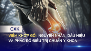 Viêm khớp gối: Nguyên nhân, dấu hiệu và phác đồ điều trị chuẩn Y khoa