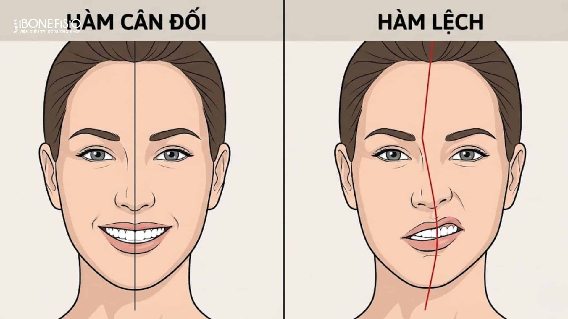Nguyên nhân xương hàm bị lệch và cách khắc phục hiệu quả 3 So sánh cấu trúc xương hàm bình thường và xương hàm bị lệch