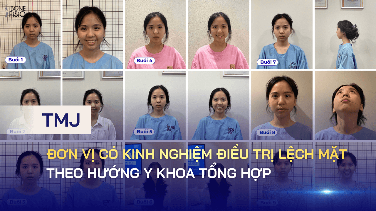 Đơn vị có kinh nghiệm điều trị lệch mặt theo hướng y khoa tổng hợp