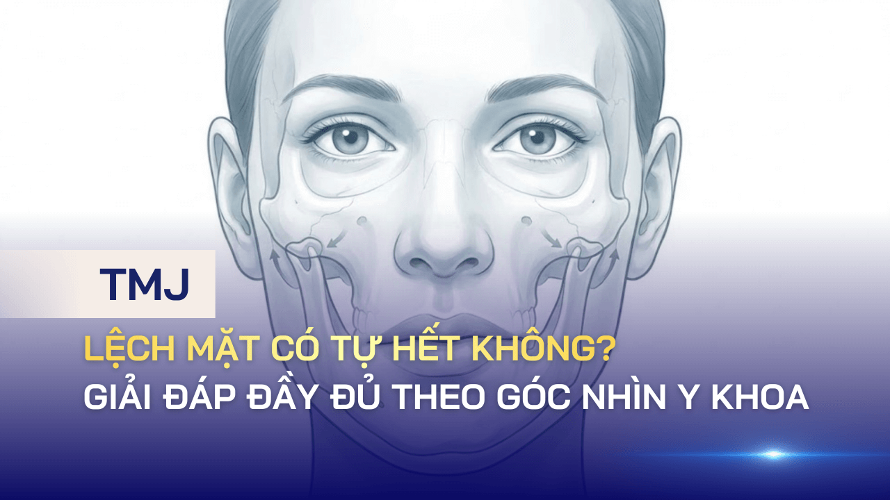Lệch mặt có tự hết không