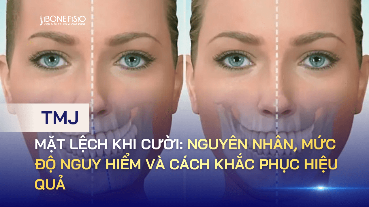 Mặt lệch khi cười: Nguyên nhân, mức độ nguy hiểm và cách khắc phục hiệu quả