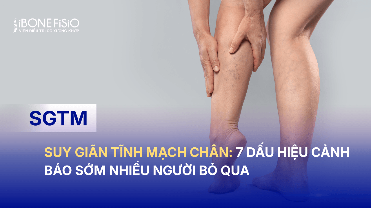 Suy giãn tĩnh mạch chân: 7 dấu hiệu cảnh báo sớm nhiều người bỏ qua
