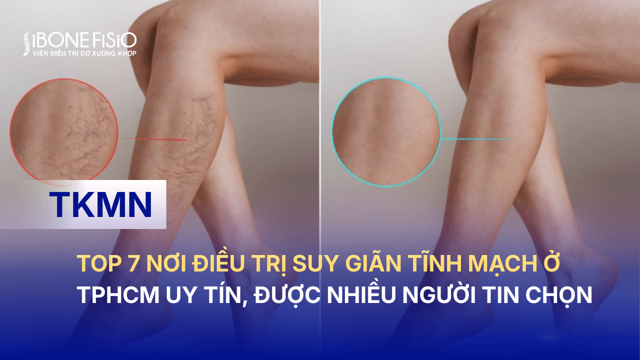 Top 7 nơi điều trị suy giãn tĩnh mạch ở TPHCM uy tín