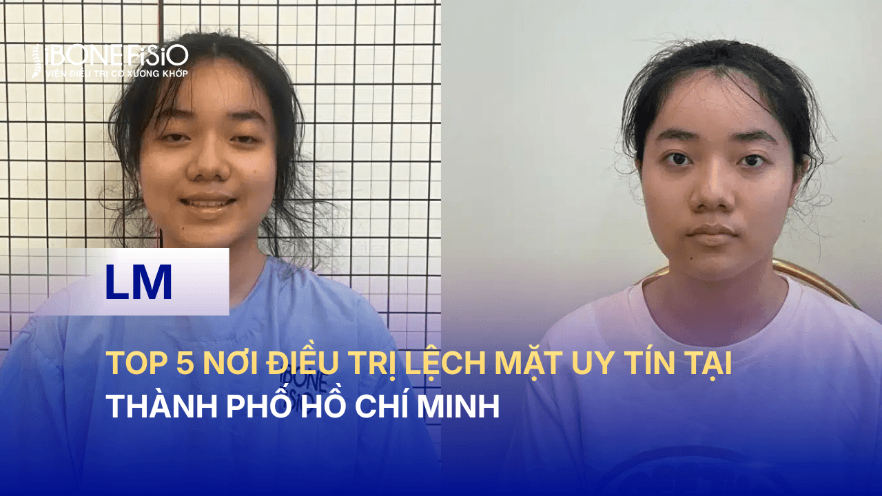 Top 5 nơi điều trị lệch mặt uy tín tại thành phố Hồ Chí Minh