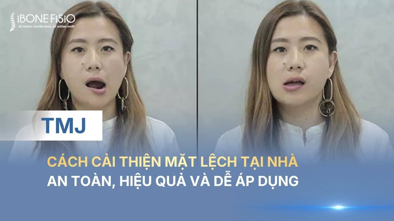 Cải thiện lệch mặt