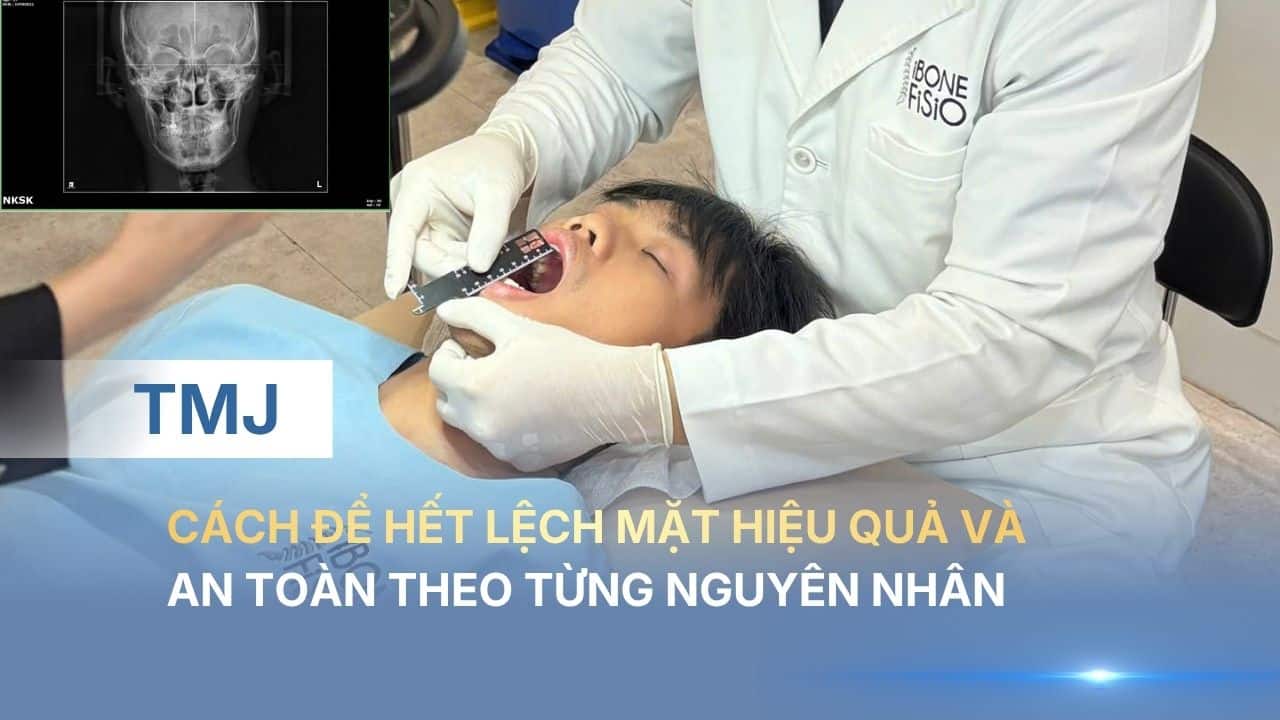 Cách để hết lệch mặt hiệu quả và an toàn theo từng nguyên nhân