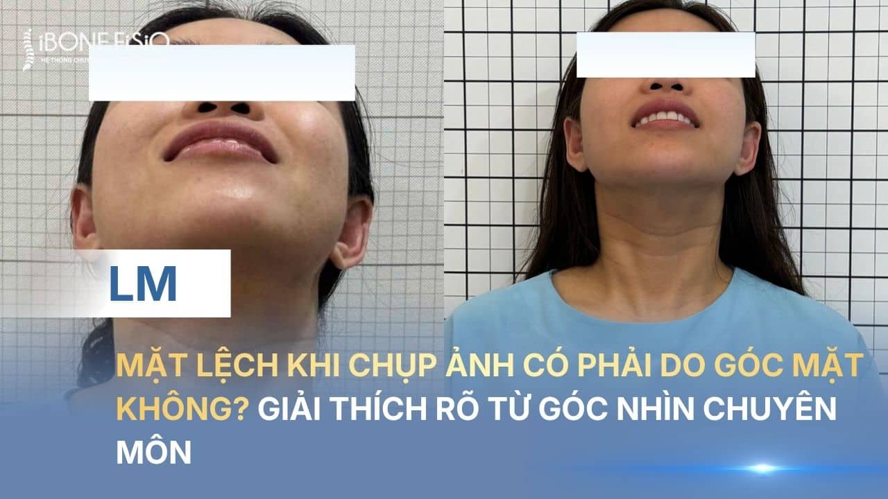 Mặt lệch khi chụp ảnh có phải do góc mặt không? Giải thích rõ từ góc nhìn chuyên môn