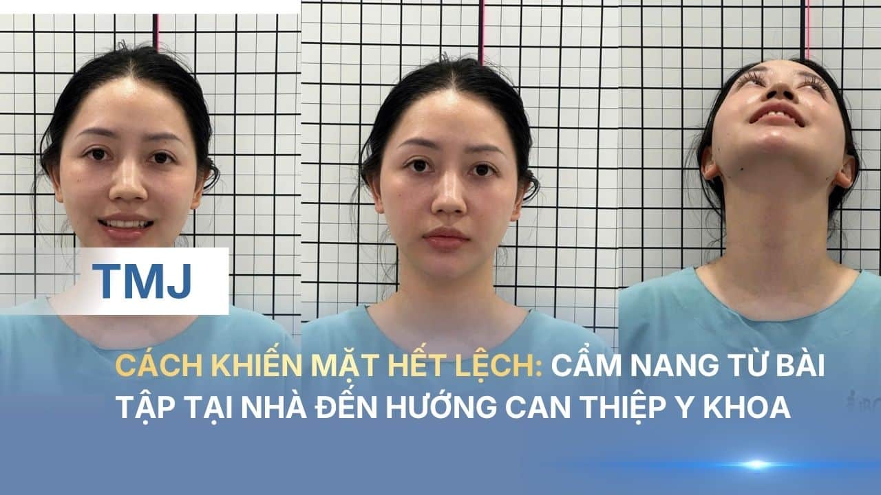 Cách khiến mặt hết lệch: Cẩm nang từ bài tập tại nhà đến hướng can thiệp y khoa
