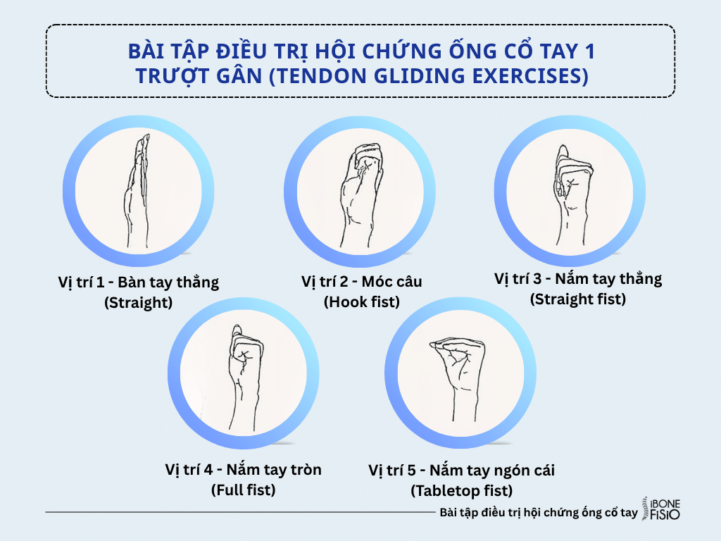 Bài tập điều trị hội chứng ống cổ tay 1: Trượt gân (Tendon Gliding Exercises) Bài tập điều trị hội chứng ống cổ tay 1: Trượt gân (Tendon Gliding Exercises)