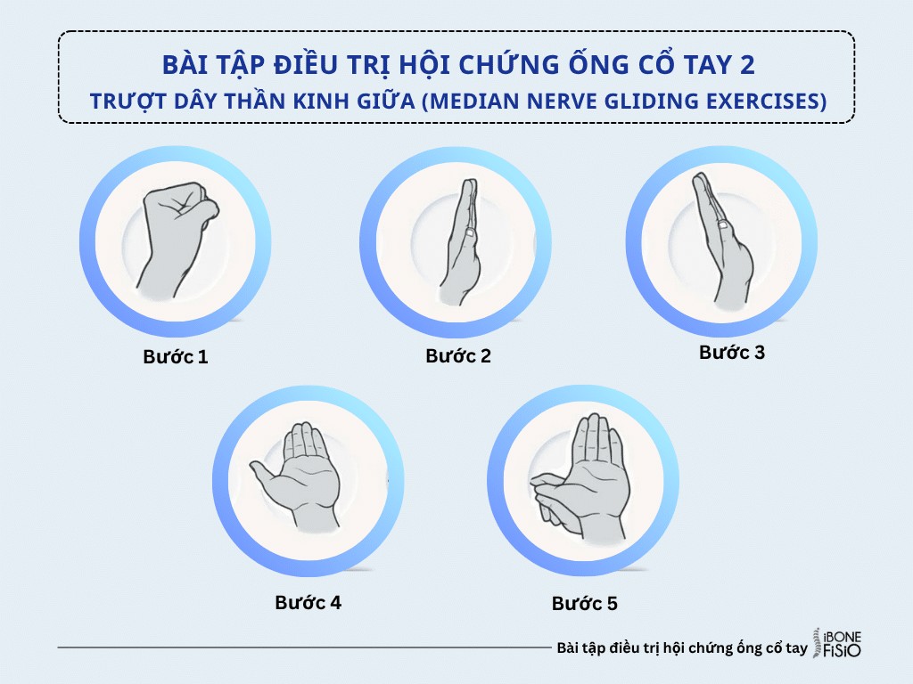 Nhóm bài tập điều trị 2: Trượt dây thần kinh giữa (Median Nerve Gliding Exercises) Nhóm bài tập điều trị 2: Trượt dây thần kinh giữa (Median Nerve Gliding Exercises)