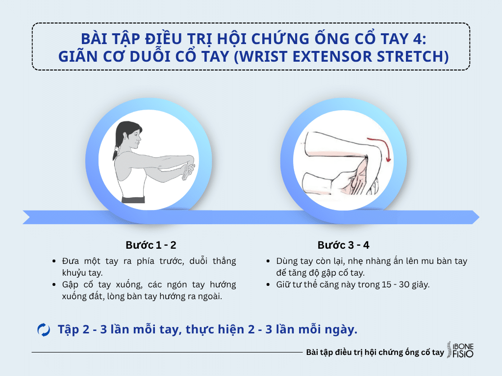 Bài tập điều trị hội chứng ống cổ tay 4: Giãn cơ duỗi cổ tay (Wrist Extensor Stretch) Bài tập điều trị hội chứng ống cổ tay 4: Giãn cơ duỗi cổ tay (Wrist Extensor Stretch)